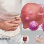 Fujian Cosunter Gains NMPA Clearance for Phase II HBV Study of GST-HG131 and GST-HG141