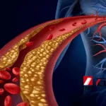 CSPC Pharmaceutical Group Gains NMPA Approval for SYH2068 siRNA Clinical Trials