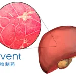 Innovent Biologics Expands Clinical Partnership with ImmVirX to Include Hepatocellular Carcinoma