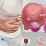 Hengrui Pharmaceuticals Receives NMPA Clearance for HRS-5635 in Chronic HBV
