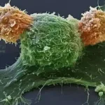Huadong Medicine's HDM2005 Receives NMPA Approval for DLBCL Clinical Trial