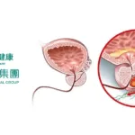 Grand Pharma Receives NMPA Review for Phase III Trial of TLX591 in Prostate Cancer
