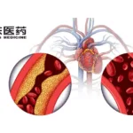 Huadong Medicine Presents DR10624 Study Results for Obesity and Hypertriglyceridemia at EASL 2025
