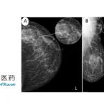 Sihuan Pharmaceutical's Bireociclib Approved by NMPA for Advanced Breast Cancer