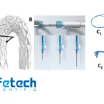 Lifetech Scientific's Aortic Arch Stent System Approved by China's NMPA