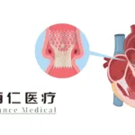 Beijing Balance Medical's Renato System Gets NMPA Approval for Valve-in-Valve Therapy