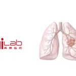 Zai Lab's ZL-1310 Receives FDA Fast Track Designation for SCLC