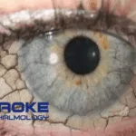Zhaoke Ophthalmology's Cyclosporine Eye Gel NDA Accepted by NMPA