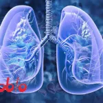 Jacobio Pharma's Glecirasib Approved by NMPA for KRAS G12C+ NSCLC
