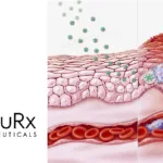 MicusRx's Contezolid Sodium NDA Accepted for Review by NMPA
