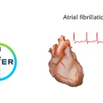 Bayer Launches Phase I Study of BAY 3670549 for Atrial Fibrillation