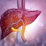 Abbisko Therapeutics' FGFR4 Inhibitor Irpagratinib Granted Breakthrough Therapy Designation for HCC