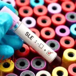 AbelZeta Pharma's C-CAR168 Secures FDA RMAT Designation for Lupus Treatments