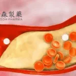 Hansoh Pharma Gains NMPA Clinical Approvals for HS-10510, HS-10542, and HS-20118