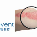 Innovent Biologics Doses First Patient in Phase III Psoriasis Trial for Picankibart
