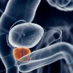 Hinova's Deutenzalutamide Approved for Metastatic Prostate Cancer in China