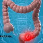 CSPC Pharmaceutical's JMT101 Receives Breakthrough Therapy Designation for Colorectal Cancer