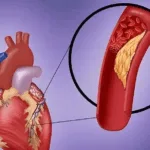 CirCode Biomed's Circular RNA Drug HM2002 Approved for US Clinical Trials