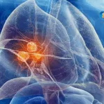 Henlius Biotech Starts Global Phase II Trial for PD-L1 ADC HLX43