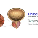 Philochem Grants RayzeBio Global Rights to OncoACP3 for Prostate Cancer