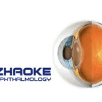 Zhaoke Ophthalmology's TAB014 Receives BLA Review for wAMD Treatment