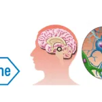 Roche Advances Prasinezumab to Phase III for Early Parkinson's Disease