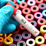 GSK Launches 'Linked by Lupus' Initiative to Support Lupus Care with $1M Funding