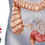 Yunnan Baiyao's JZ-14 Gets NMPA Clinical Clearance for Ulcerative Colitis Trial