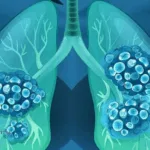Dizal's Phase III Trial Completes Enrollment for Shuwozhe in EGFR Exon20ins NSCLC