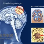 Shandong Xinhua Pharma Initiates Phase II Study of OAB-14 for Alzheimer's Disease