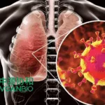 Vcanbio Submits Clinical Trial Application for VUM02 in Severe Pneumonia Treatment