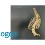 Biogen's Phase I Results Highlight Salanersen's Potential in Spinal Muscular Atrophy