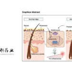 Angel Pharma Gains NMPA Approval for Soquelitinib in Atopic Dermatitis Trial