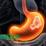 CARsgen's Satri-cel NDA Accepted by China's NMPA for Gastric Adenocarcinoma