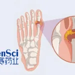 Changchun GeneScience's Firsekibart Receives NMPA Approval for Acute Gouty Arthritis