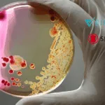 BioVersys Partners with Shionogi to Advance BV500 for Non-Tuberculous Mycobacterial Infections