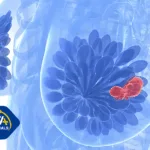 Betta Pharmaceuticals' Kangmeina Approved by NMPA for Advanced Breast Cancer Treatment