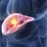 CStone Pharmaceuticals Announces Phase III Trial Progress for Nofazinlimab in Hepatocellular Carcinoma