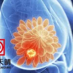 Jiangsu CTTQ's TQB2102 Receives Breakthrough Therapy Designation for HER2+ Breast Cancer