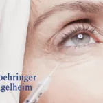 Boehringer Ingelheim Starts Phase III THULITE Study for BI 1815368 in Diabetic Macular Edema
