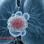 Zelgen's ZG006 Receives Breakthrough Therapy Designation for Advanced Small Cell Lung Cancer