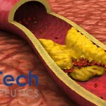 YolTech Therapeutics Receives NMPA Clearance for YOLT-101 in HeFH Clinical Study