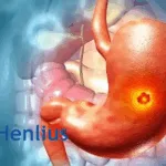 Shanghai Henlius Biotech Initiates US Patient Dosing in Phase III Trial for HER2-Positive Gastric Cancer