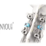 Shanghai Sanyou Medical Receives NMPA Marketing License for JAZZ Spinal Fixation System
