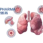 Fosun Pharma's Zhejiang Xinghao Unit Initiates Phase Ib Study for COPD DPP-1 Inhibitor XH-S004