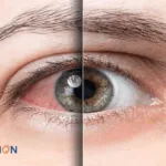 VivaVision Biotech Closes D2+ Funding Round, Advancing Ophthalmic Therapies
