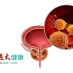 Grand Pharma’s TLX591 Granted NMPA Approval for Phase III Prostate Cancer Trial