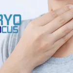 Cryofocus Medtech's Asthma Cryoablation System Granted FDA Breakthrough Device Designation