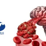 Hengrui Pharmaceuticals' HRS8179 and HRS-1893 Receive NMPA Clinical Trial Approval