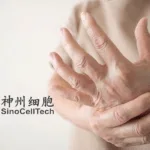 SinoCellTech's SCT640C Injection Receives NMPA Approval for RA Clinical Trials